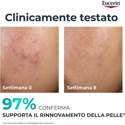 Средство для отшелушивания кожи лица Eucerin Dermopure Clinical
