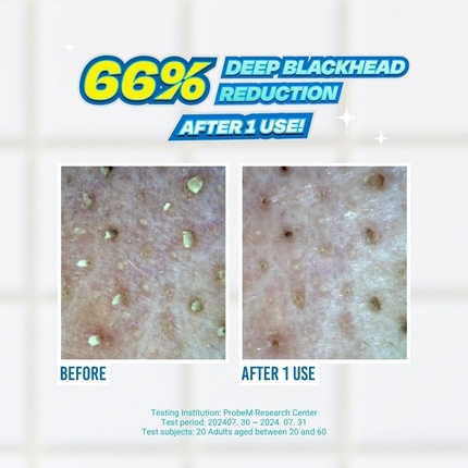 Умягчитель Jumiso Blackhead Melting Softener Набор с ватными дисками