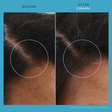 Средство для ухода за кожей головы Treatment Living Proof Scalp Care Revitalizing Treatment