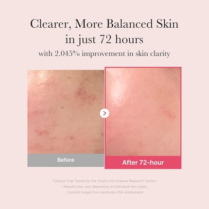 Сыворотка Medicube Txa Niacinamide Serum 15