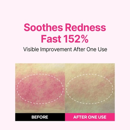 Увлажняющая сыворотка Isoi Blemish Care Up Serum