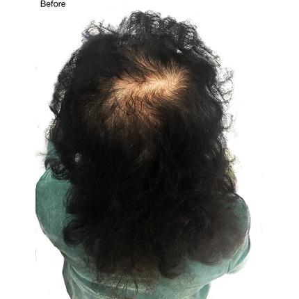 Волокна для густоты волос Nanogen Hair Thickening Fibres