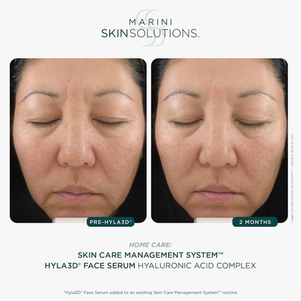 Marini Skinsolutions Hyla3D Сыворотка для лица