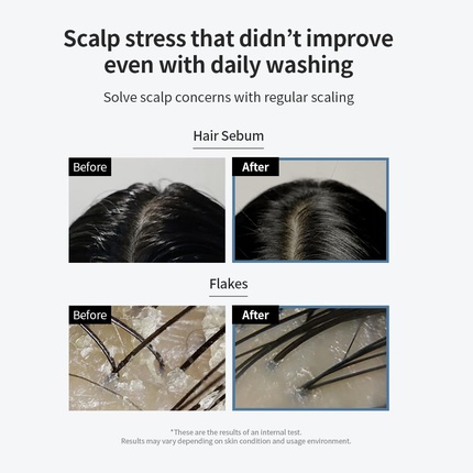 Scalp Scaler Grow Gorgeous