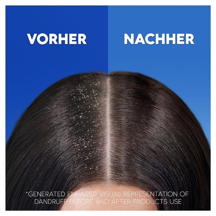 Shampoo Head & Shoulders Apple Fresh